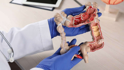 Doctor holding intestines showing inflammation